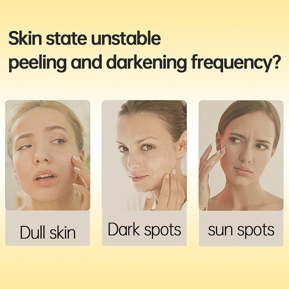 Ensemble de soins pour la peau à l'acide kojique, crème, sérum, nettoyage, savon