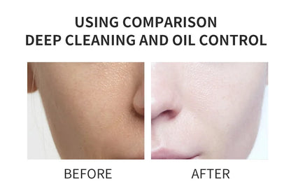 Nettoyant visage à l'acide kojique 150 ml