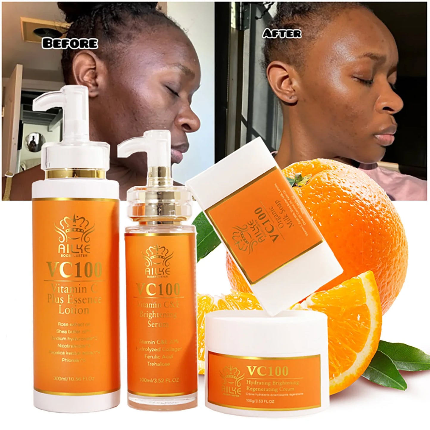 AILKE Ensemble 4 en 1 blanchissant à la vitamine C, peau lisse