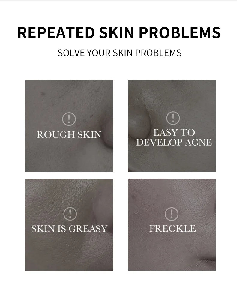 Nettoyant visage à l'acide kojique 150 ml