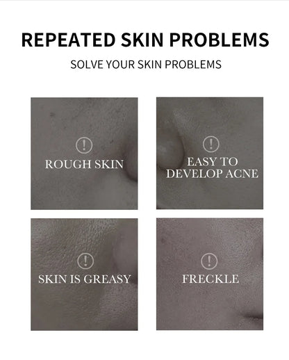 Nettoyant visage à l'acide kojique 150 ml