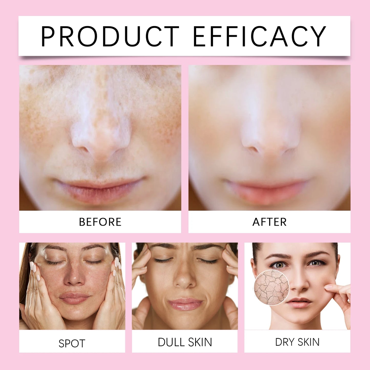 La crème hydratante à l'acide kojique hydrate la peau, pour le visage 50g