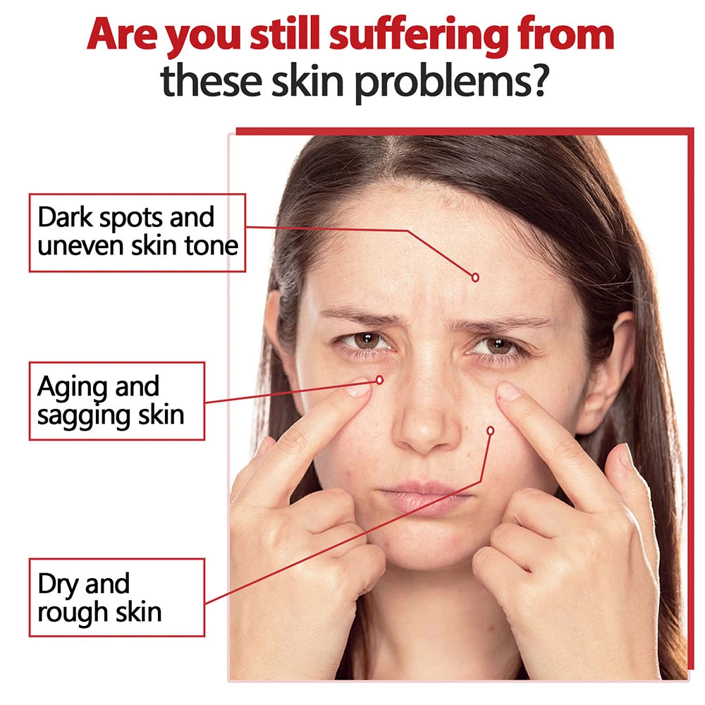 Ensemble de soins pour la peau à l'acide kojique, crème, sérum, nettoyage, savon