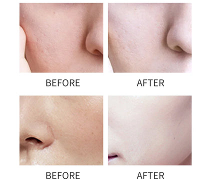 Nettoyant visage à l'acide kojique 150 ml